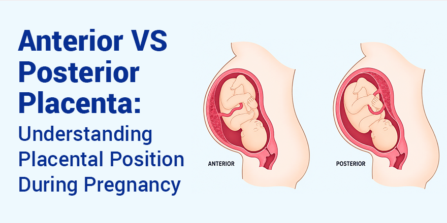 Anterior vs Posterior Placenta: Understanding Placental Position During Pregnancy